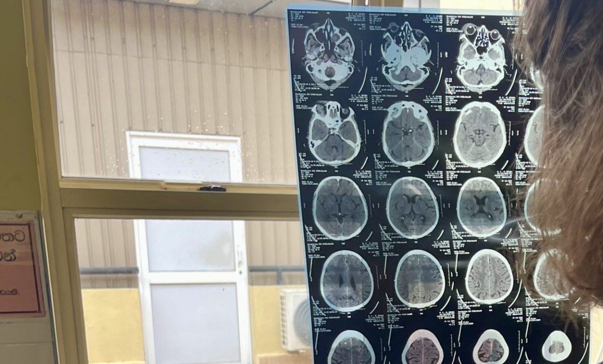 Erfahrungsbericht über mein 4-monatiges Praktikum in der Allgemeinen Chirurgie am Karapitiya Teaching Hospital in Galle, Sri Lanka